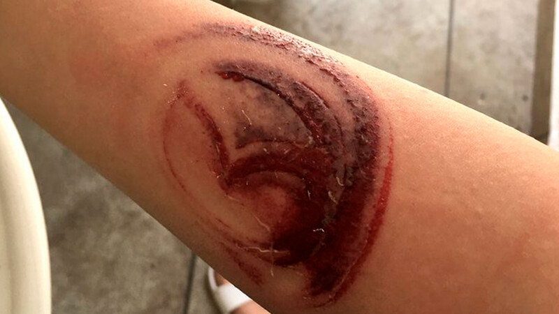Mujer choca y se le queda tatuado el logo de Mazda, busca patrocinio